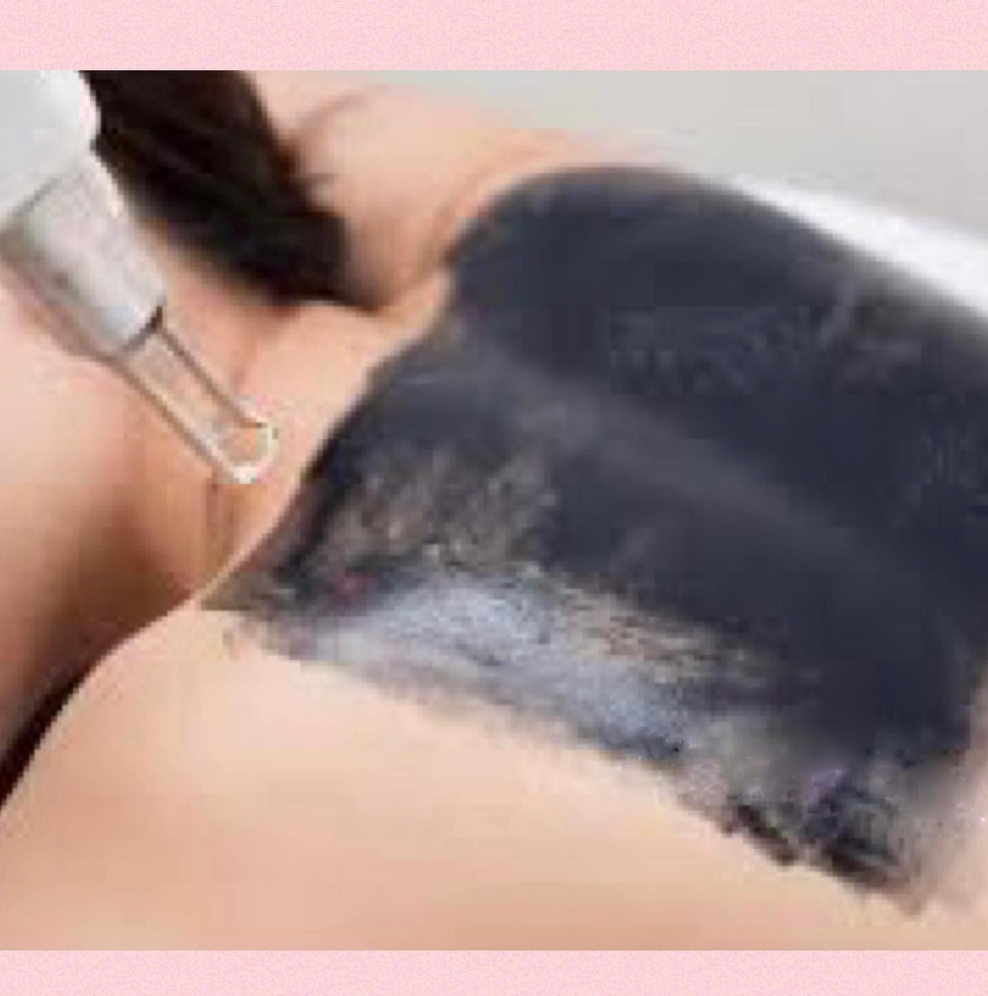 美之家美容中心服務-激光護理